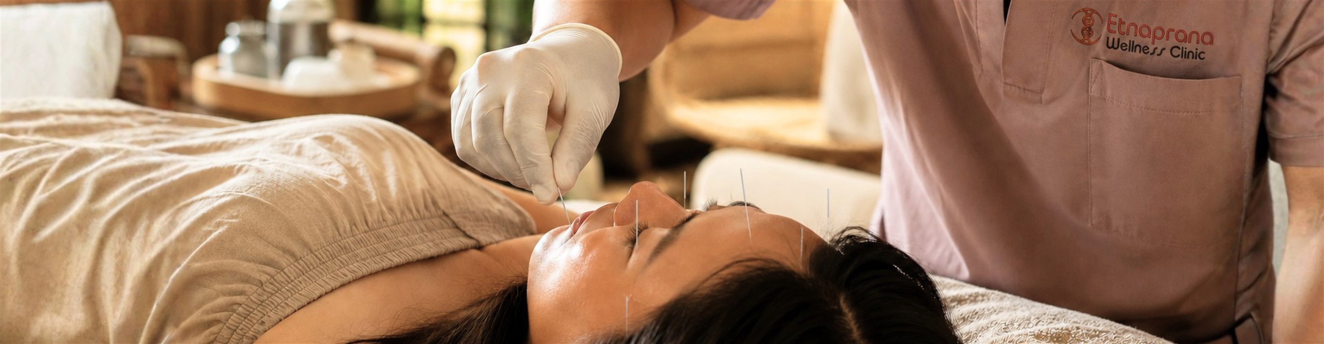 Wellness Acupuncture